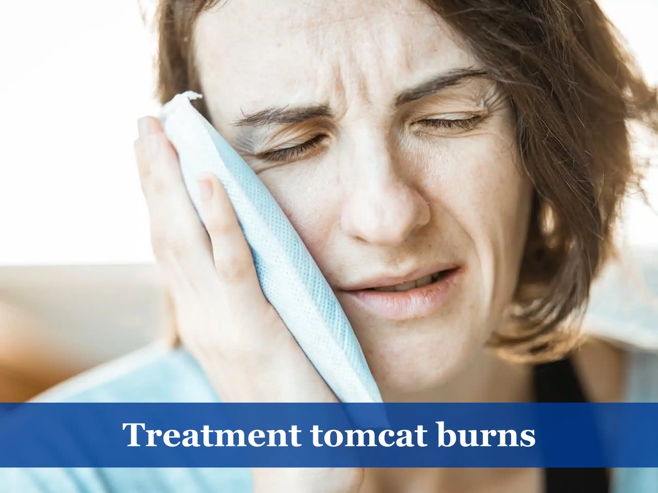 Treatment Tomcat burns