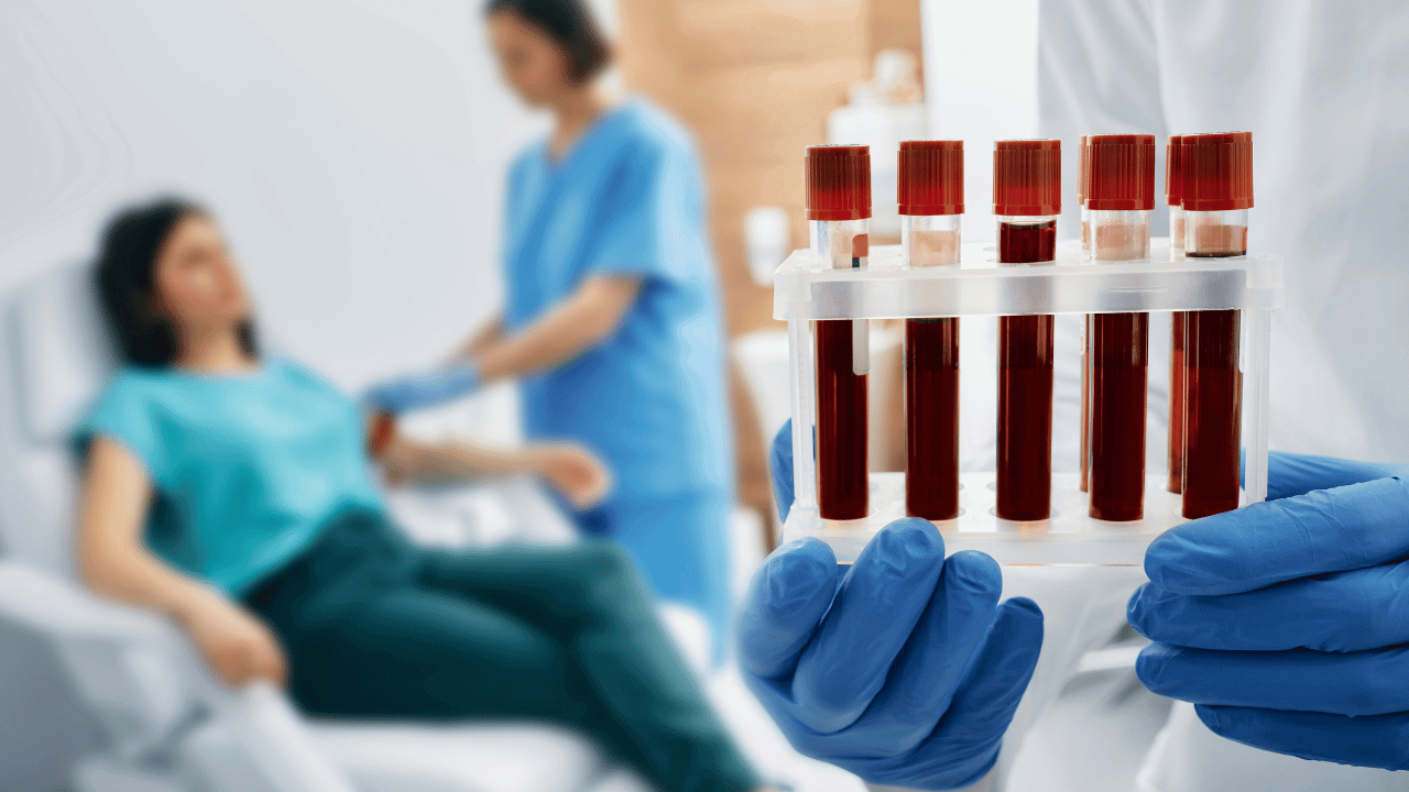 Hormonal Testing at Saline Bali Clinic