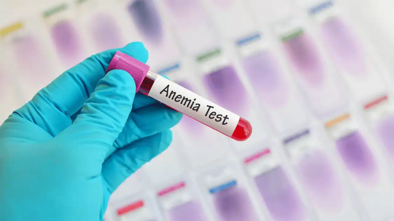 Anemia Panel Test at Saline Bali Clinic