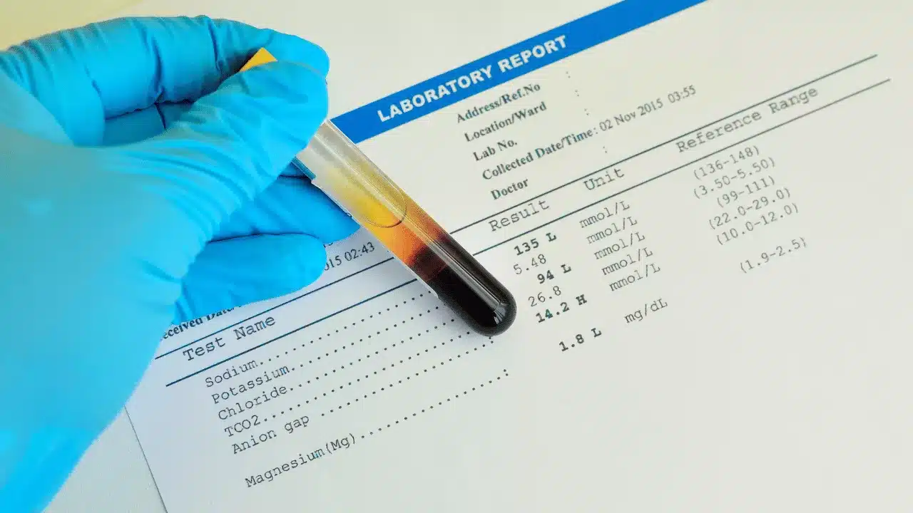 Blood Electrolyte Tests Available at Saline Bali Clinic