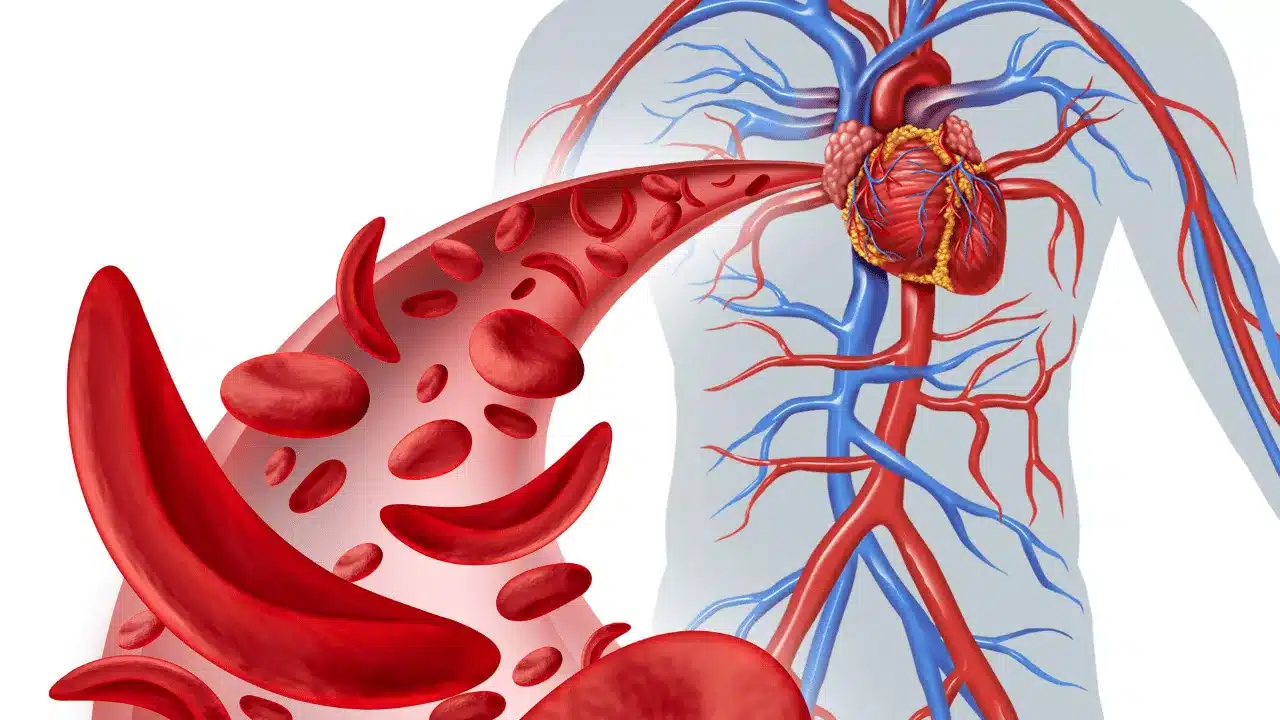 Common Types of Anemia