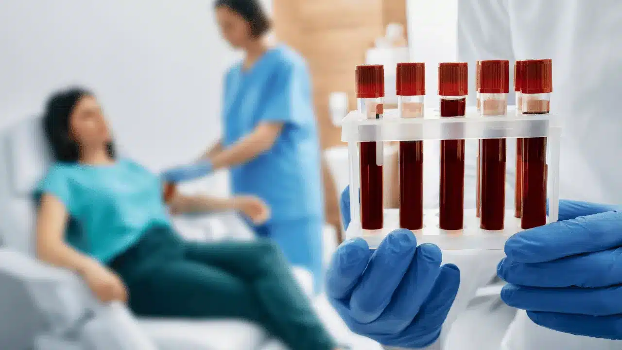 Find the Typhoid Fever Test at Saline Bali Clinic
