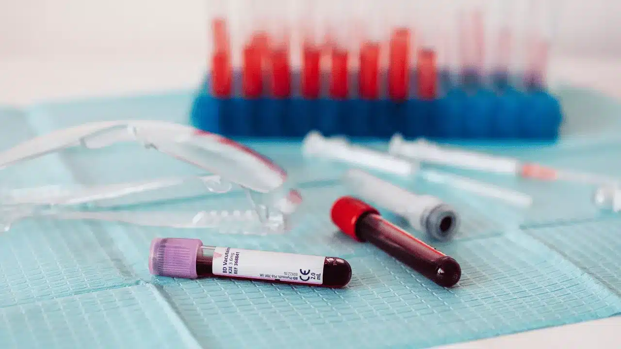 What Is a Blood Electrolyte Test