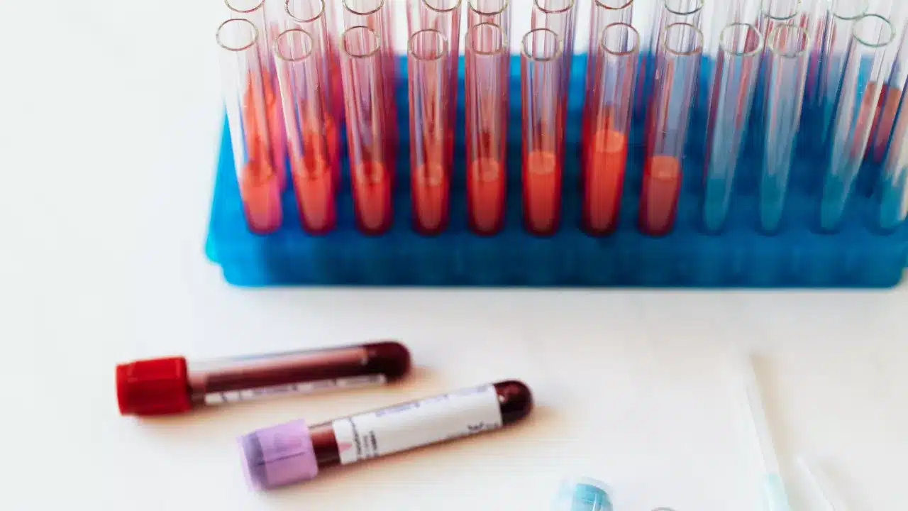 What Is a Respiratory Infection Test?