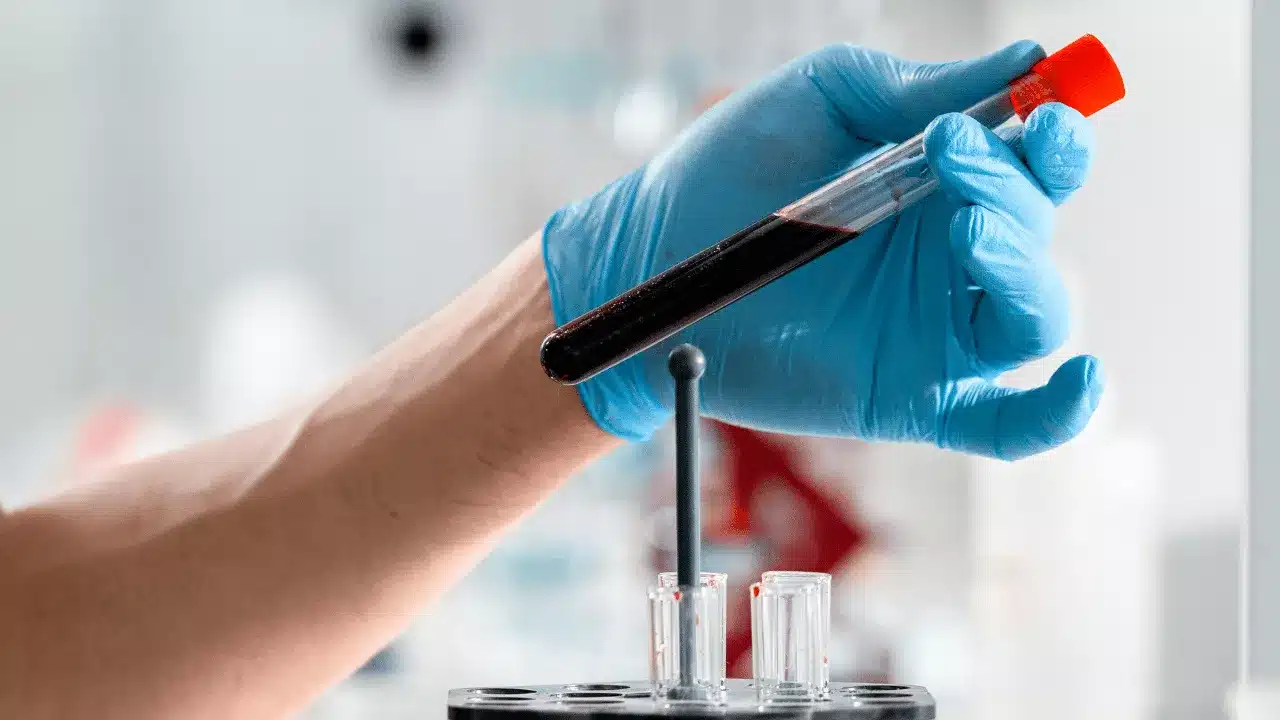 When Is the Right Time to Take a Blood Electrolyte Test