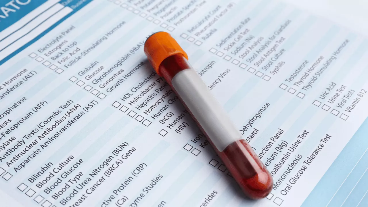 Why Choose Saline Bali Clinic for Your Blood Electrolyte Test