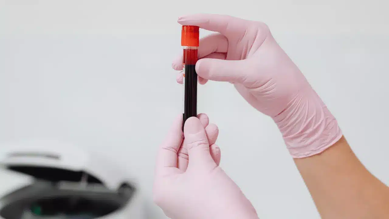 Why Early Detection of Anemia Is Important