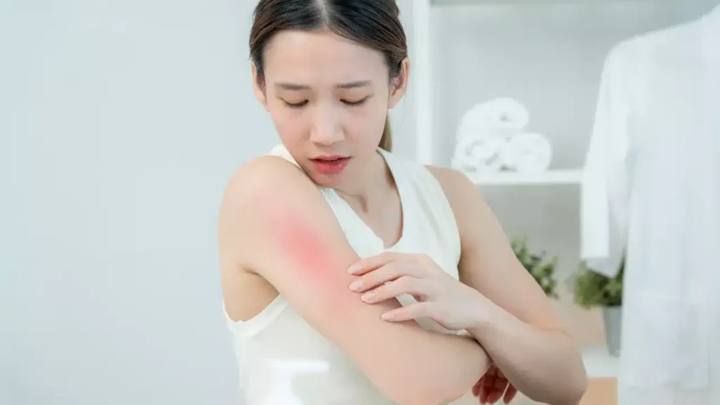 Complications of Chickenpox