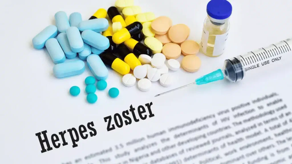Why You Should Consider the Herpes Zoster Vaccine​