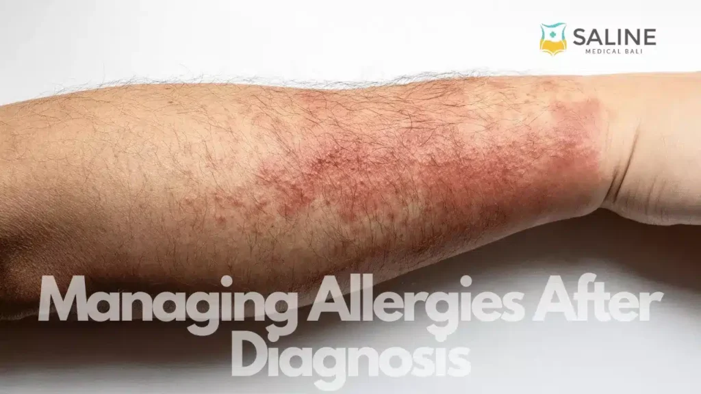 Managing Allergies After Diagnosis