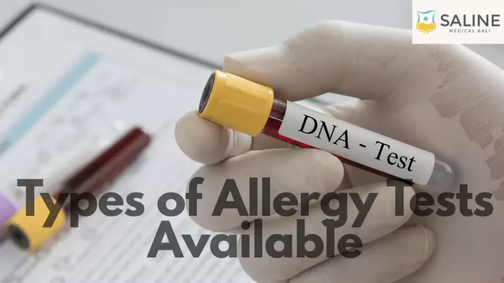 Types of Allergy Tests Available