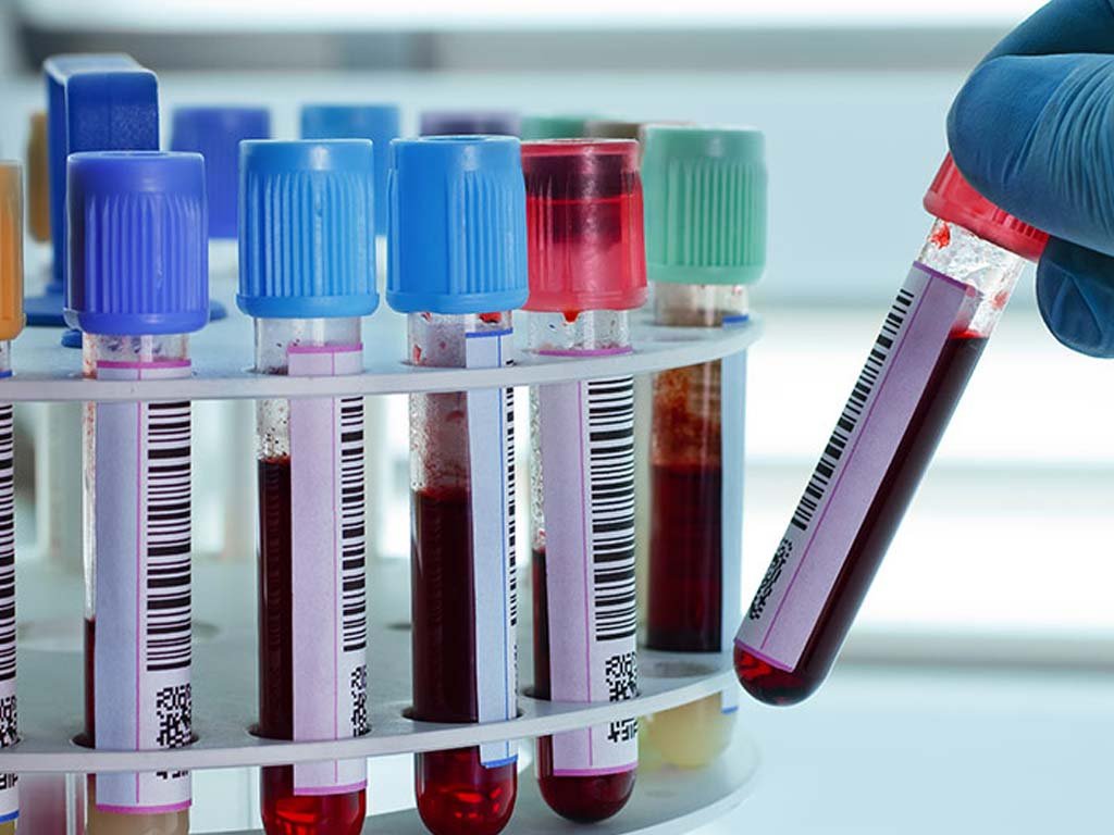 Lab Services Web