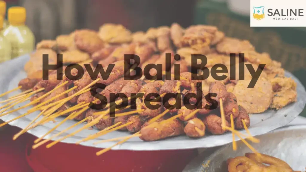 How Bali Belly Spreads