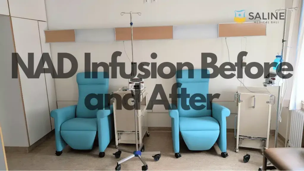 NAD Infusion Before and After - What to Expect
