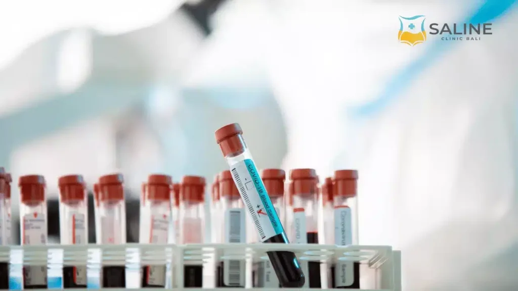 Types of Gastrointestinal Infection Tests
