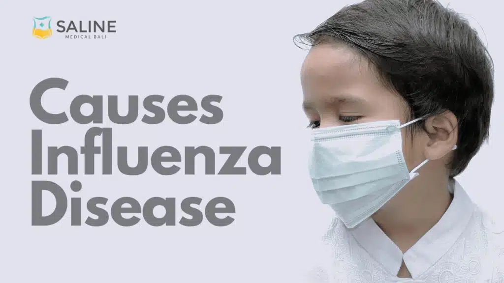 Causes of Influenza Disease