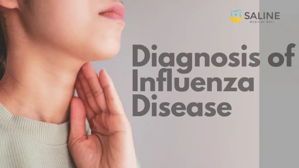 Diagnosis of Influenza Disease