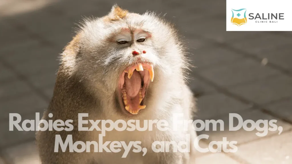 Rabies Exposure From Dogs Monkeys and Cats