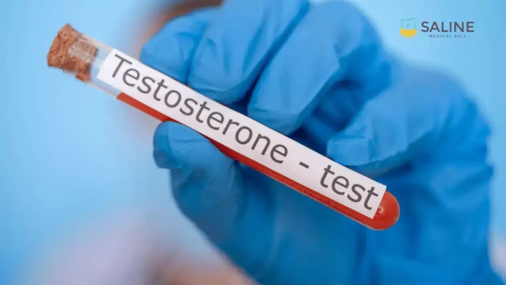 Testosterone Test Bali