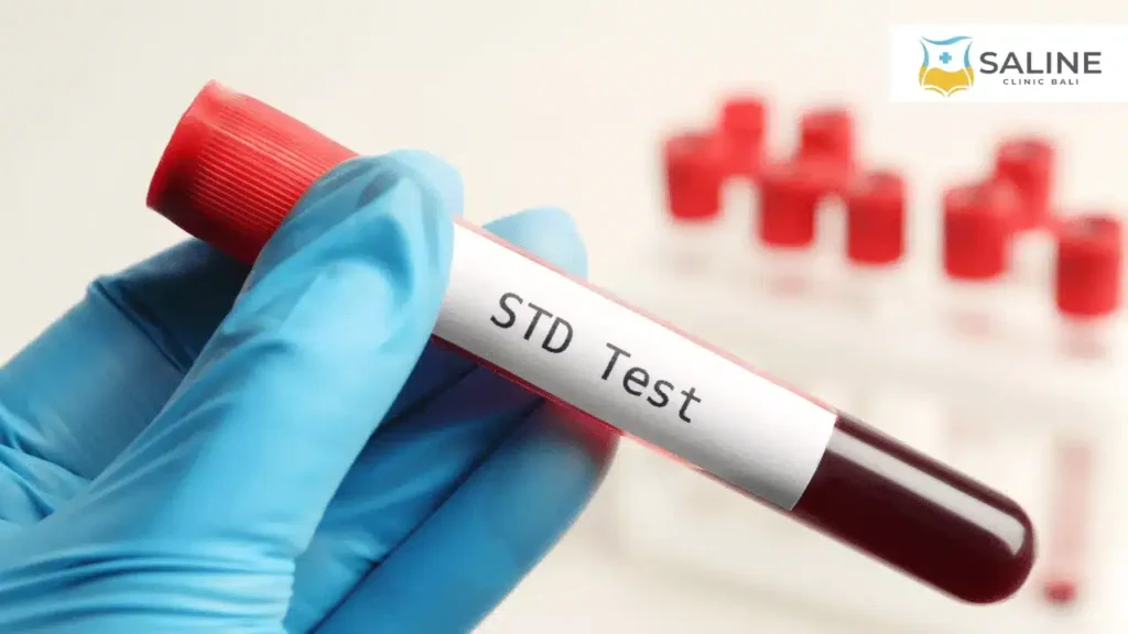 Why STD Testing Matters